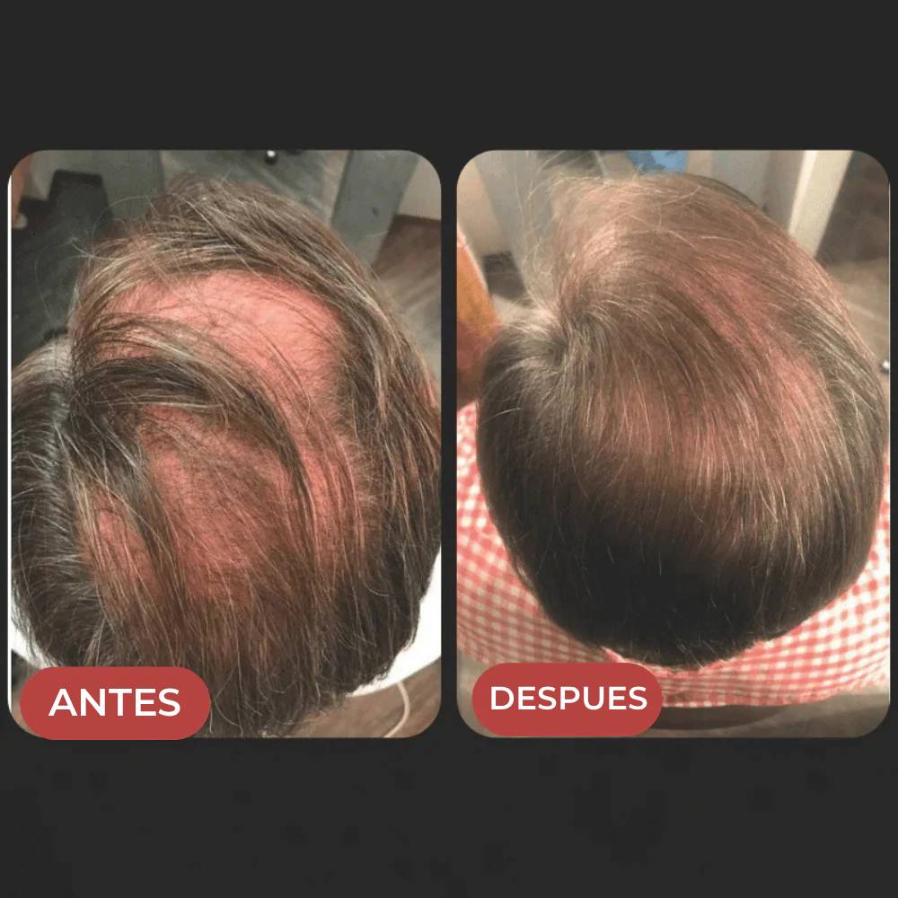 Valora Revive Sérum Capilar Roll-on