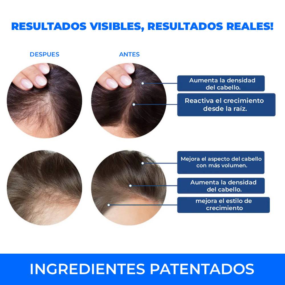 Valora Revive Sérum Capilar Roll-on